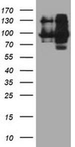 DPP9 Antibody in Western Blot (WB)