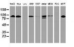 DPP9 Antibody in Western Blot (WB)