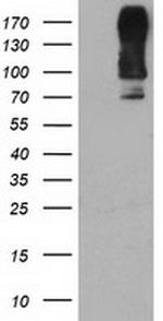 DPP9 Antibody in Western Blot (WB)