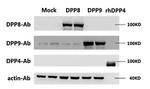 DPP9 Antibody in Western Blot (WB)
