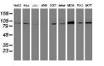 DPP9 Antibody in Western Blot (WB)