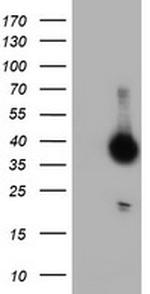 DPPA4 Antibody in Western Blot (WB)