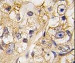 RGMB Antibody in Immunohistochemistry (IHC)