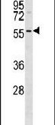 DRAK1 Antibody in Western Blot (WB)
