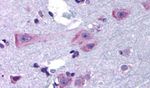 DRD3 Antibody in Immunohistochemistry (Paraffin) (IHC (P))