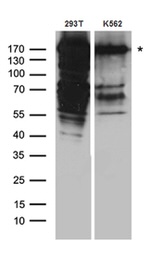 DSG1 Antibody in Western Blot (WB)