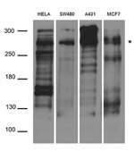 DSP Antibody in Western Blot (WB)