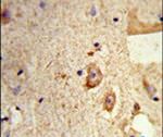 Destrin Antibody in Immunohistochemistry (IHC)