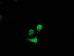 DSTN Antibody in Immunocytochemistry (ICC/IF)