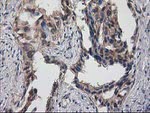 DSTN Antibody in Immunohistochemistry (Paraffin) (IHC (P))