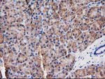 DSTN Antibody in Immunohistochemistry (Paraffin) (IHC (P))