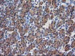 DSTN Antibody in Immunohistochemistry (Paraffin) (IHC (P))