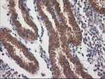 DSTN Antibody in Immunohistochemistry (Paraffin) (IHC (P))