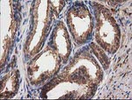 DSTN Antibody in Immunohistochemistry (Paraffin) (IHC (P))