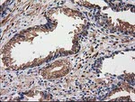 DSTN Antibody in Immunohistochemistry (Paraffin) (IHC (P))