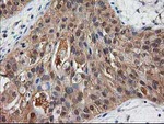DSTN Antibody in Immunohistochemistry (Paraffin) (IHC (P))