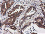 DSTN Antibody in Immunohistochemistry (Paraffin) (IHC (P))