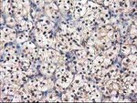 DSTN Antibody in Immunohistochemistry (Paraffin) (IHC (P))