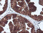 DSTN Antibody in Immunohistochemistry (Paraffin) (IHC (P))