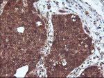 DSTN Antibody in Immunohistochemistry (Paraffin) (IHC (P))