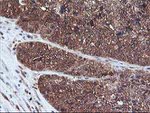 DSTN Antibody in Immunohistochemistry (Paraffin) (IHC (P))