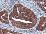 DSTN Antibody in Immunohistochemistry (Paraffin) (IHC (P))