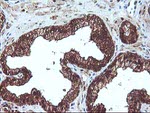 DSTN Antibody in Immunohistochemistry (Paraffin) (IHC (P))
