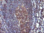 DSTN Antibody in Immunohistochemistry (Paraffin) (IHC (P))