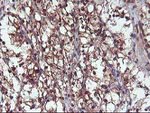 DSTN Antibody in Immunohistochemistry (Paraffin) (IHC (P))