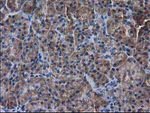 DSTN Antibody in Immunohistochemistry (Paraffin) (IHC (P))