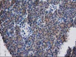 DSTN Antibody in Immunohistochemistry (Paraffin) (IHC (P))