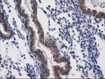 DSTN Antibody in Immunohistochemistry (Paraffin) (IHC (P))