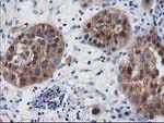 DSTN Antibody in Immunohistochemistry (Paraffin) (IHC (P))