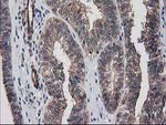 DSTN Antibody in Immunohistochemistry (Paraffin) (IHC (P))