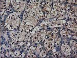 DSTN Antibody in Immunohistochemistry (Paraffin) (IHC (P))