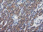 DSTN Antibody in Immunohistochemistry (Paraffin) (IHC (P))