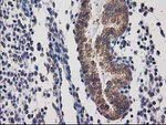 DSTN Antibody in Immunohistochemistry (Paraffin) (IHC (P))
