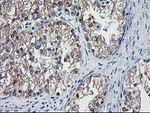 DSTN Antibody in Immunohistochemistry (Paraffin) (IHC (P))