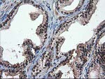 DSTN Antibody in Immunohistochemistry (Paraffin) (IHC (P))