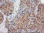 DSTN Antibody in Immunohistochemistry (Paraffin) (IHC (P))