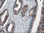 DSTN Antibody in Immunohistochemistry (Paraffin) (IHC (P))