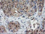 DSTN Antibody in Immunohistochemistry (Paraffin) (IHC (P))