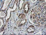 DSTN Antibody in Immunohistochemistry (Paraffin) (IHC (P))