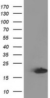 DSTN Antibody in Western Blot (WB)