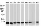DSTN Antibody in Western Blot (WB)