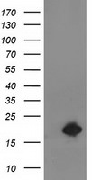 DSTN Antibody in Western Blot (WB)
