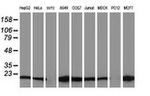 DSTN Antibody in Western Blot (WB)