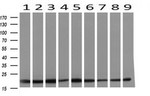 DSTN Antibody in Western Blot (WB)