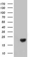 DSTN Antibody in Western Blot (WB)