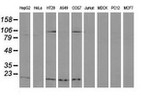 DSTN Antibody in Western Blot (WB)